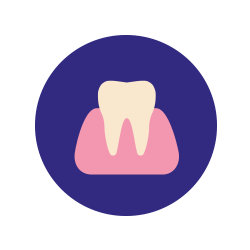 diente tinción