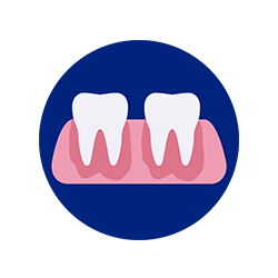 implantes dentales